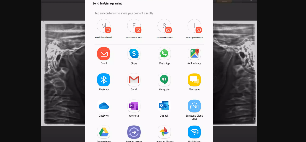 X-Ray Mobile V.2.0 Apk (Güncel) İndir 2022