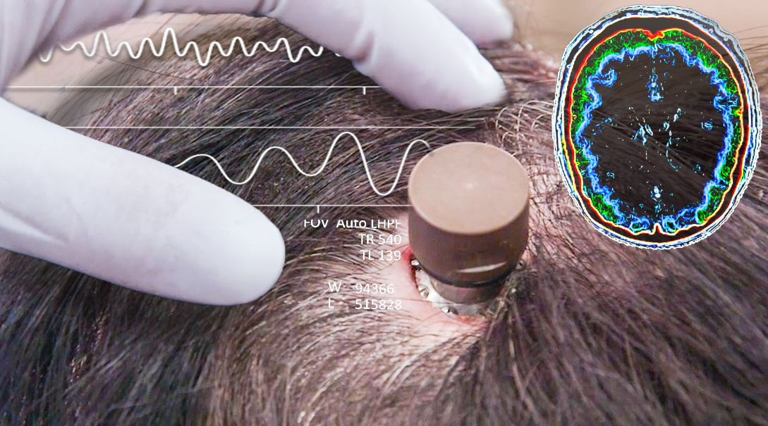 Neuralink &Ccedil;ip