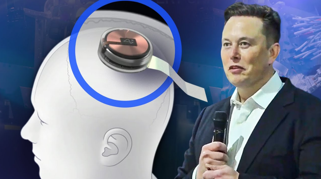 Neuralink Çip Nedir, Ne İşe Yarar? (2023)