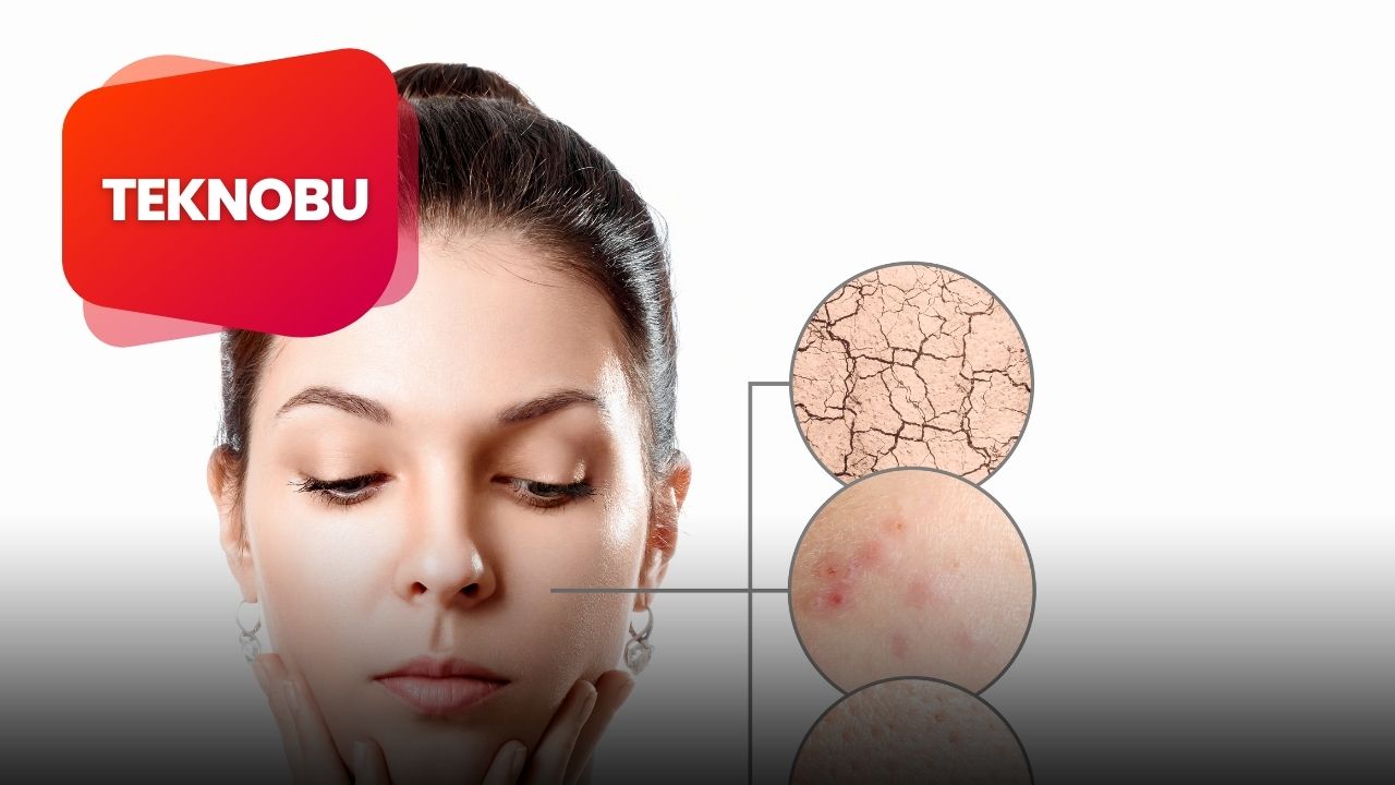 Berces Protokolü Nedir? Nasıl Yapılır? (2023) 3 teknobu 2023 03 30T154537.252