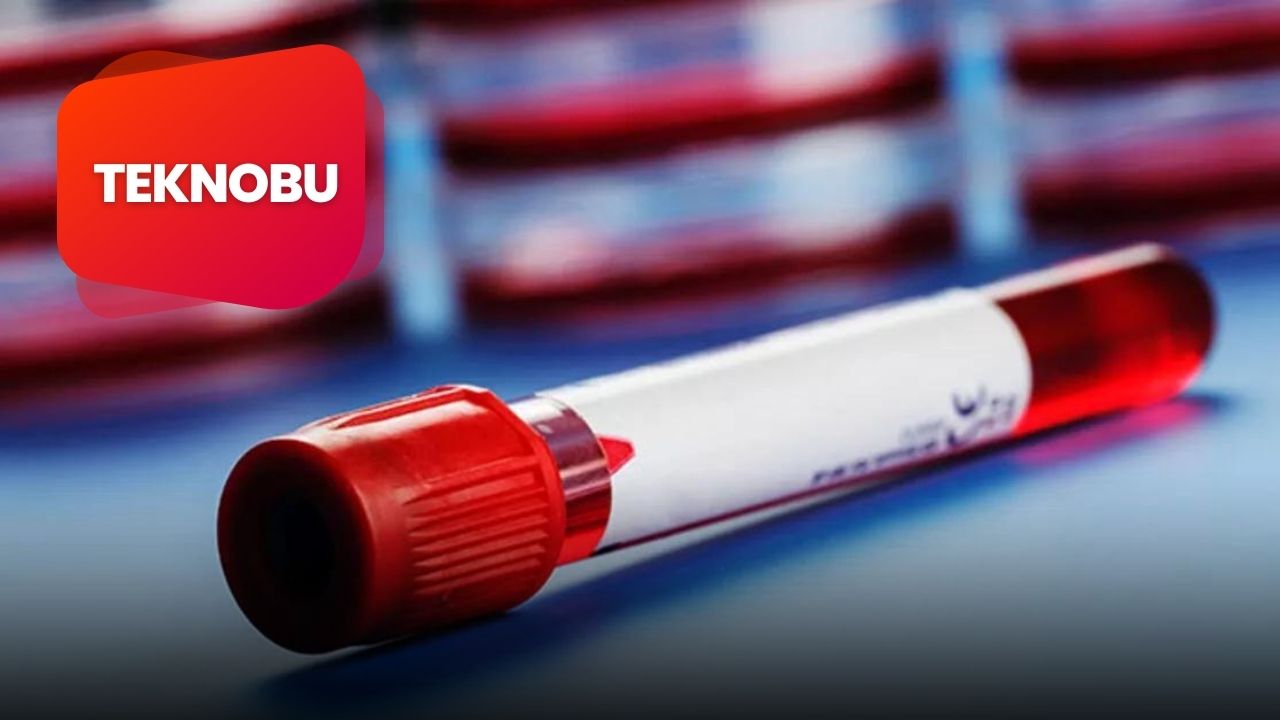 Nrbc 0 Çıkması Ne Demek? 2 Nrbc 0 Çıkması Ne Demek?