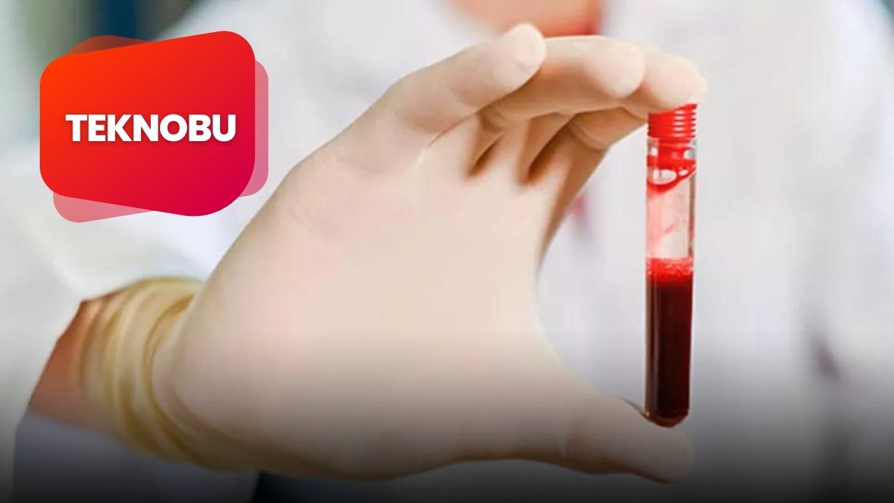 Nrbc 0 Çıkması Ne Demek? 3 teknobu 2023 03 30T165940.188