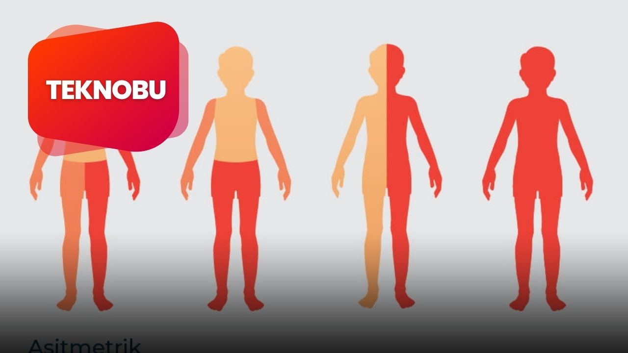 Kuadripleji Nedir? Ne Anlama Geliyor? (2023) 1 Kuadripleji Nedir? Ne Anlama Geliyor? (2023)